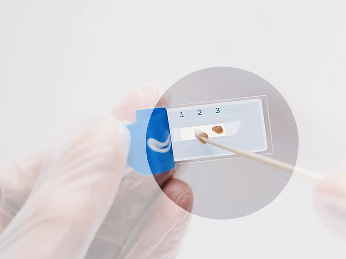 Placa diagnóstica AMA RUT Expert con biopsias gástricas
