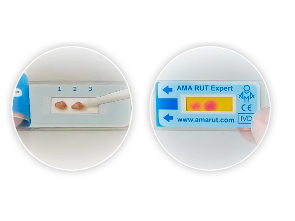 Test de Ureasa Expert