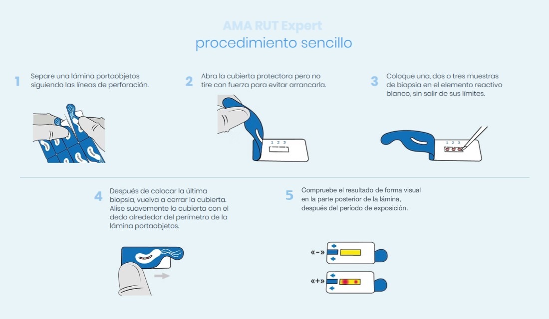 Procedimiento del test de ureasa AMA RUT Expert